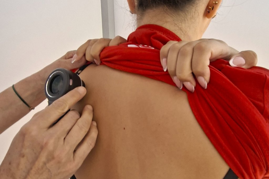 U subotu obavite besplatni dermatološki pregled u Bjelovaru! Zastiti se i uzivaj na suncu 2